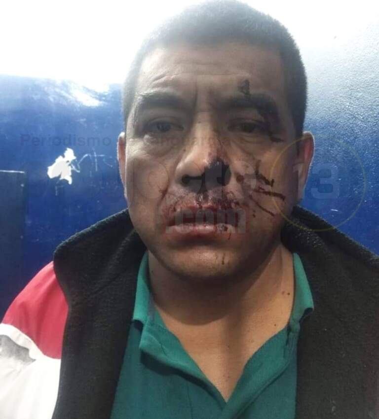 Protestan en Atzacan, “policías golpearon a taxista”