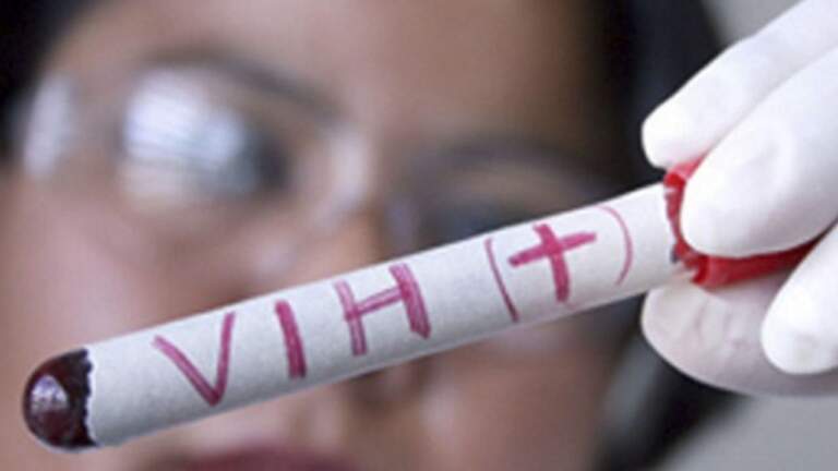 Descubren nueva variante del VIH altamente contagiosa